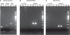 Fotos de corridas electroforéticas de PCR realizadas para la identificación de fusiones. A) Genes Control: GUSβ en líneas 1 y 2. PAX8 en líneas 3 y 4. TSH en líneas 5 y 6. Se observan las bandas positivas de la muestra M1. B) Fusión PAX8/PPARG: Se observa en las líneas 1, 2, 3 y 4 la primer PCR de las muestras M1 y M2. En las líneas 5, 6, 7, 8 y 9 se encuentra la nested PCR; se puede observar la banda correspondiente a la presencia de la fusión PAX8/PPARG en la muestra M2 y el correspondiente control positivo. C) Fusión RET/PTC1. En las líneas 1, 2, 3 y 4 la primer PCR de las muestras M1 y M3. En las líneas 5, 6, 7, 8 y 9 se encuentra la nested PCR. Se pueden observar las bandas correspondientes a la presencia de la fusión RET/PTC1 en la muestra M3 y el control positivo. MP: marcador de peso molecular. C(+): control positivo. C(−): control negativo. CN: control negativo de las nested PCR. M1, M2 y M3 son muestras de pacientes diferentes.