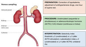 Adrenal venous sampling: preparation, protocols, and interpretation.