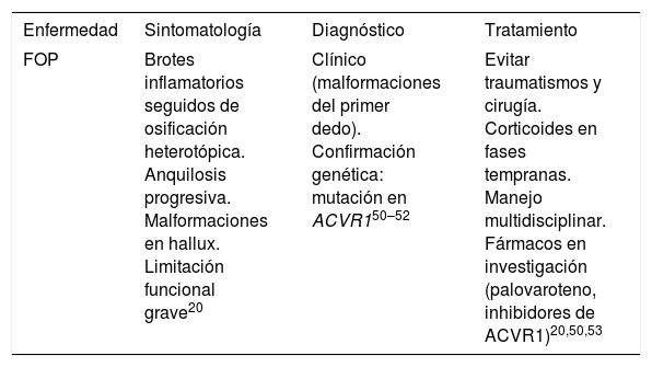 Tablas