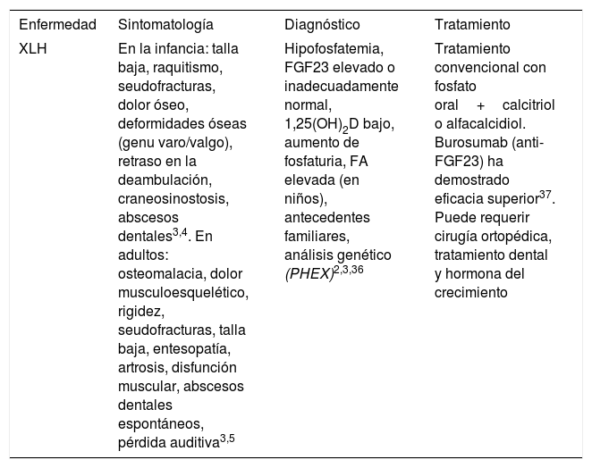 Tablas