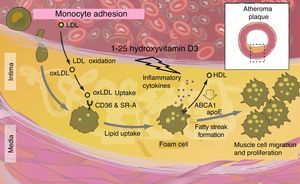 Effects of vitamin D in atherosclerosis.