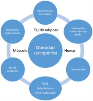 Etiopathogenesis of sarcopenic obesity.