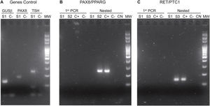 Photos of electrophoretic PCR runs performed for the identification of fusions. A) Genes Control: GUSβ in lines 1 and 2. PAX8 in lines 3 and 4. TSH in lines 5 and 6. The positive bands of the S1 sample are observed. B) PAX8/PPARG fusion: The primer PCR of samples S1 and S2 is observed in lines 1, 2, 3 and 4. The nested PCR is in lines 5, 6, 7, 8 and 9; the band corresponding to the presence of the PAX8/PPARG fusion can be observed in the S2 sample and the corresponding positive control. C) RET/PTC1 fusion. The primer PCR of samples S1 and S3 is observed in lines 1, 2, 3 and 4. The nested PCR is in lines 5, 6, 7, 8 and 9 The bands corresponding to the presence of the RET/PTC1 fusion can be observed in the S3 sample and the positive control. MW: molecular weight marker. C(+): positive control. C(−): negative control. NC: negative control of the nested PCRs. S1, S2 and S3 are samples from different patients.
