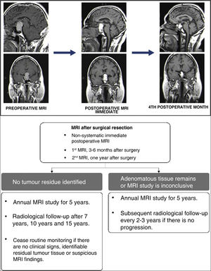 Upper: evolution of pituitary adenoma four °months after surgery. Lower: radiological follow-up with MRI for non-functioning PitNETs. Translated and adapted from Cortet-Rudelli et al.55, 2015.