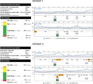 Adapted from FreeStyle Libre – Libreview reports for Patient 1 and Patient 2.