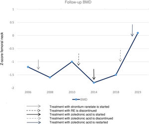 Progression of BMD, measured as Z-score in the femoral neck. *Due to metal fixations in the spine, BMD cannot be measured at this location.