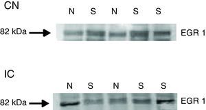 Western blost mostra a imunorreatividade de egr‐1 em biópsias (punch) com o NCD/NCVp e CI de ratos virgens de tratamento e após o tratamento com salicilato de sódio (N, virgens; S, salicilato).