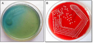 A, Crescimento confluente e isoladas de colônias verdes de P. aeruginosa na placa de ágar nutriente; B, Colônias incolores de S. aureus (MRSA) resistente à meticilina na placa de ágar sangue.