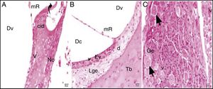 Grupo cisplatina: mR, membrana de Reissner; Dv, duto vestibular; Dc, duto coclear; ponta da flecha curva, membrana basilar; d, degeneração e dilatação; v, vacuolização; seta curva, membrana tectorial; Nc, nervo coclear; Ev, estria vascular; Lge, ligamento espiral; Ge, gânglio espiral; seta preta, células ganglionares espirais (coloração hematoxilina eosina, × 40).