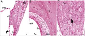 Grupo cisplatina + 100mg/kg uva‐do‐monte; mR, membrana de Reissner; Dc, duto coclear; ponta da flecha curva, membrana basilar; cid, célula interdental; Cc, célula ciliada interna d, degeneração e dilatação; seta curva, membrana tectorial; Nc, nervo coclear; Ev, estria vascular; Lge, ligamento espiral; Ge, gânglio espiral; seta preta, células ganglionares espirais (coloração hematoxilina eosina, × 40).