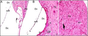 Grupo cisplatina + 200mg/kg uva‐do‐monte; mR, membrana de Reissner; Dv, duto vestibular; Dc, duto coclear; ponta da flecha curva, membrana basilar; d, degeneração e dilatação; v, vacuolização; seta curva, membrana tectorial; Nc, nervo coclear; Ev, estria vascular; Lge, ligamento espiral; Ge, gânglio espiral; seta preta, células ganglionares espirais (coloração hematoxilina eosina, × 40).