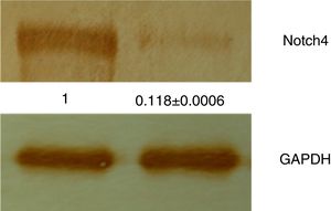 Proteínas totais isoladas das amostras de tecido de CVO e CCEO foram analisadas por Western Blot com o uso do anticorpo anti‐Notch4. Os blots se evidenciaram com o uso de DAB, revelaram uma alta expressão de Notch4 em amostras de CCEO, enquanto uma expressão muito fraca foi observada em amostras de CVO. Todos os experimentos foram feitos em triplicata e os dados foram analisados adicionalmente por densitometria, GAPDH serviu como normalizador.