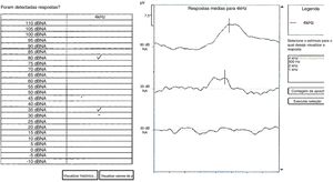 Um exemplo de estimativa de limiar de potencial evocado auditivo cortical automático para 4000Hz. No exemplo, o equipamento considerou respostas epresentes em 80 e 35 dBNA. A linha contínua negra indica a latência de P1 considerada pelos três examinadores.