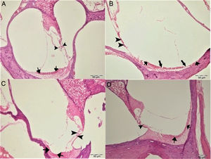 Aparência histopatológica da cóclea, H&E, escala: 50μm. (A) Grupo Controle, estrutura histopatológica normal da cóclea (seta, estria vascular, ponta da seta, células ciliadas externas). (B) Grupo Cisplatina, hiperemia (setas mais finas), degeneração e erosão (setas mais grossas) na estria vascular, diminuição do número de células ciliadas externas (pontas de setas). (C) Grupo Ácido gálico, estrutura histopatológica normal da cóclea (seta, estria vascular, ponta da seta, células ciliadas externas). (D) Grupo Cisplatina + ácido gálico, hiperemia leve na estria vascular (setas), estrutura histopatológica normal de células ciliadas externas com diminuição moderada do número dessas células (ponta de seta).