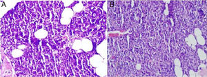 (A) Acúmulo de muco nas células acinares da glândula parótida no grupo de excisão unilateral da glândula submandibular (400×, microscópio óptico, H&E). (B) Acúmulo de muco nas células acinares da glândula parótida do grupo de excisão bilateral da glândula submandibular (400×, microscópio óptico, H&E).