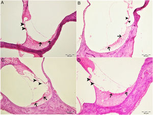 Aspecto histopatológico da cóclea, H&E, Barra: 50μm. A, grupo Controle. Estrutura histopatológica normal da cóclea (Seta, Estria Vascular; Ponta da flecha, células ciliadas externas). B, Grupo Cisplatina. Hiperemia, degeneração e erosão na estria vascular (setas), diminuição acentuada do número de células ciliadas externas (pontas de setas). C, Grupo Eugenol. Estrutura histopatológica normal da cóclea (Seta, Estria Vascular; Ponta de seta, células ciliadas externas). D, Grupo Cisplatina+Eugenol: Hiperemia leve na estria vascular (setas), estrutura histopatológica normal das células ciliadas externas com discreta diminuição do número dessas células (Ponta de seta).