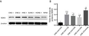Detecção da expressão da proteína SGK3 em linhagens de células de CNF. (A) Expressão representativa da proteína SGK3 em diferentes linhagens celulares de CNF e células NP69 detectadas por análise de Western blot. (B) Análise do valor de cinza da expressão da proteína SGK3 como a proporção entre a SGK3 e a p‐actina nos resultados de Western blot; a SGK3 foi mais altamente expressa na maioria das linhagens de células de CNF (CNE‐2, HNE‐1, SUNE‐1) do que nas células NP69 (p < 0,01).