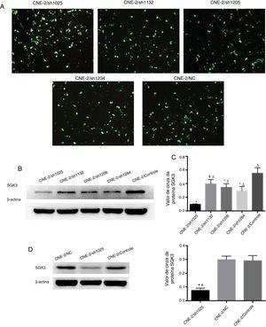 Melhor rastreamento de shRNA da SGK3 e eficiência do silenciamento da SGK3 pelo shRNA específico em células CNE‐2. (A) Expressão verde fluorescente da proteína em células CNE‐2 observada por microscopia de fluorescência após transfecção com o shRNA da SGK3 ou plasmídeo NC. (B) Expressão representativa da proteína SGK3 em células CNE‐2 tratadas com diferentes plasmídeos de shRNA da SGK3 determinadas por análise de Western blot. (C) Análise do valor de cinza de expressão da proteína SGK3 como a proporção entre a SGK3 e a p‐actina em resultados de Western blot. O plasmídeo sh1025 mostrou o efeito mais significativo no knockdown da SGK3 (p < 0,01). (D) Expressão representativa da proteína SGK3 nos grupos shSGK3, NC e controle determinados por análise de Western blot. (E) Análise do valor cinza da expressão da proteína SGK3 como a proporção entre a SGK3 e a β‐actina nos resultados de Western blot; a expressão da SGK3 no grupo shSGK3 foi obviamente reduzida em comparação com a dos grupos NC e controle (*#p < 0,01).