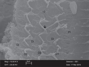 Imagem de microscopia eletrônica de varredura (MEV) das estruturas das células ciliadas externas (D1‐D2‐D3) cercadas por células de Deiters (Di) no grupo NAC. Imagem das áreas de aderências na seção apical dos estereocílios  e as áreas de perda na célula ciliada externa  PI, células pilares internas (× 10.000).