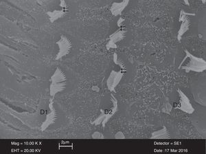 Imagem dos estereocílios irregulares (D1 – D2 – D3) das células ciliadas externas  no grupo cisplatina (×10.000).