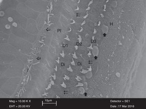 Área de perda parcial  nos estereocílios das células ciliadas internas (İ) e perda total  nas células ciliadas externas (D1‐D2‐D3) no grupo cisplatina. Visualização de protrusões em forma de balão  nas células ciliadas externas adjacentes às células de Deiters (Di). Pİ, células pilares internas; H, célula de Hensen (x 3.000).