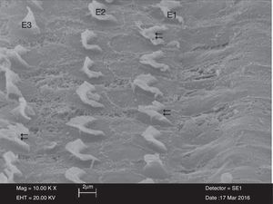 Imagem dos estereocílios irregulares e aderidos  das células ciliadas externas (E1‐E2‐E3) no grupo cisplatina + NAC (× 10.000).