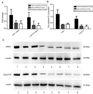 Detecção da expressão gênica e dos níveis de expressão proteica dos receptores de histamina H1 e leucotrieno CysLT1 de participantes antes e após a medicação. A, Quantificação dos níveis de mRNA dos receptores de histamina H1 e leucotrieno CysLT1 analisados por qPCR. B, Quantificação dos níveis de proteína dos receptores de histamina H1 e leucotrieno CysLT1 analisados por Western Blot. C, Imagens de Western Blot das proteínas de histamina H1, leucotrieno CysLT1 e controle. Antes do tratamento: faixas 1, 2, 3; pós‐tratamento: faixas 4, 5, 6 e controle saudável: Faixas 7, 8. β‐actina e γ‐tubulina foram respectivamente usados como controle para os receptores de histamina H1 e leucotrieno CysLT1 em qPCR e Western Blot.