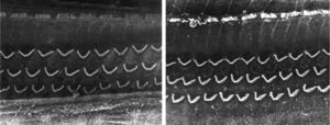 Fotos da região do órgão de Corti de cobaias do Grupo 1 (emprego de tetróxido de ósmio, sem uso de EDTA).