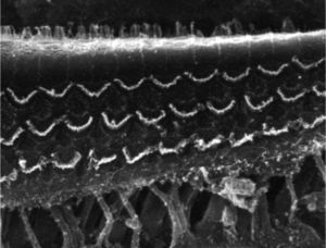 Foto da região do órgão de Corti de uma cobaia do Grupo 1 (emprego de tetróxido de ósmio, sem uso de EDTA), com a presença de fissura próxima às células ciliadas externas.