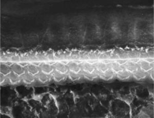 Foto da região do órgão de Corti de uma cobaia do Grupo 2 (emprego de EDTA e azul de toluidina, sem uso de tetróxido de ósmio), com a presença de fissura próxima às células ciliadas externas.