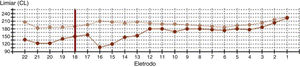 Telemetria de resposta neural intraoperatória: a primeira medida (ponta) é representada pela linha bege e a segunda medida (reinserção) por uma linha laranja. A linha vermelha vertical marca o limite distal da ponta caracol (e18–e22).