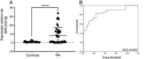 O miR‐223‐3p é altamente expresso e serve como um biomarcador clínico em pacientes com RA. (A) O nível de expressão de miR‐223‐3p em pacientes com RA (n=41) foi significativamente maior do que em participantes saudáveis (n=39). (B) Análise da curva ROC do diagnóstico de RA para o marcador miR‐223‐3p. AUC: área sob a curva. A significância estatística foi avaliada com o teste t de Student bicaudal. A barra de erro indica o DP. (**** p <0,0001).