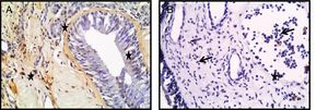 Fotomicrografias de coloração TUNEL nos tecidos de conchas nasais (A) e PNs (B). As células TUNEL‐positivas foram identificadas pela coloração marrom (estrela) (Seta: eosinófilos) (A, B; ampliação original × 400).