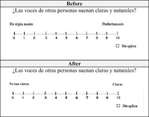 Exemplo de formato de avaliação obtido da pergunta 10da parte 3 do SSQ em espanhol colombiano.
