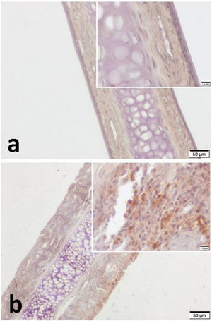 Análise imuno‐histoquímica de VPAC2 para (a) o grupo controle e (b) o grupo de ratas grávidas. Verificou‐se que o VPAC2 mostra coloração em todas as camadas do mucopericôndrio septal. A hipercelularidade subepitelial foi notável no grupo de ratas grávidas (b). A intensidade geral da coloração foi mais explícita nas amostras do grupo de ratas grávidas. (escala=50μm e 10μm).