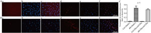 A, Coloração por imunofluorescência com Math1 em CPNs após indução de diferenciação (×200). (a e d) são coloração com Math1 (os núcleos corados exibem fluorescência vermelha); (b e e) são núcleos corados com DAPI (os núcleos corados exibem fluorescência azul); (c e f) combinam as duas primeiras imagens. B, Coloração por imunofluorescência com Myosin?a em CPNs após indução de diferenciação. (a e d) são coloração com Myosin?a (o citoplasma corado exibe fluorescência vermelha); (b e e) núcleos corados com DAPI (os núcleos corados exibem fluorescência azul); (c e f) combinam as duas primeiras imagens. C, Proporção de marcadores de células ciliadas coradas positivamente em CPNs após indução de diferenciação.