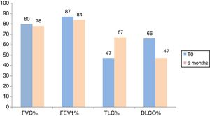 Average values of FVC, FEV1, TLC and DLCO percentage predicted at time 0 (n=30), after 6 months (n=16) in patients treated with Nintedanib. No statistical significant differences among these groups were observed (p>0.05).