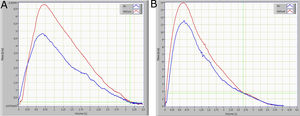 A. Forced expiratory flow-volume curves on breathing air (blue curve) and the mixture 80% He and 20% O2 (red curve) in a control subject. B. Same as A of a typical OSAHS patient. Green lines show the point at where the two curves coincide (VisoV˙).