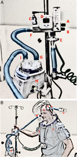 Flow delivery system configuration: MAX VENTURI System connected to a helmet. A: A MAX VENTURI system is provided with 2 knobs to independently set oxygen and air. Knob (A) regulates oxygen percentage, Knob (B) regulates air, (C) oxygen cell and read on the display (D). protected by a HEPA filter (E). The outlet of the venturi system is connected to the inlet port (G) of the water chamber of an active humidifier (H) through an insulated circuit (F) From the outlet port of the water chamber another insulated circuit (I) connects the helmet inlet port as shown in B. B: A MAX VENTURI system is connected to the helmet (L) inlet port (M) through an insulated circuit (I) coming from the water chamber of the humidifier (H). The expiratory helmet port (N), protected with a HEPA filter (Q), is provided with a PEEP valve (O). Two armpit braces (P) keep the helmet in place. MAX VENTURI can be coupled to an active humidifier.