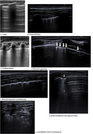 Findings of the LU imaging described in the study.