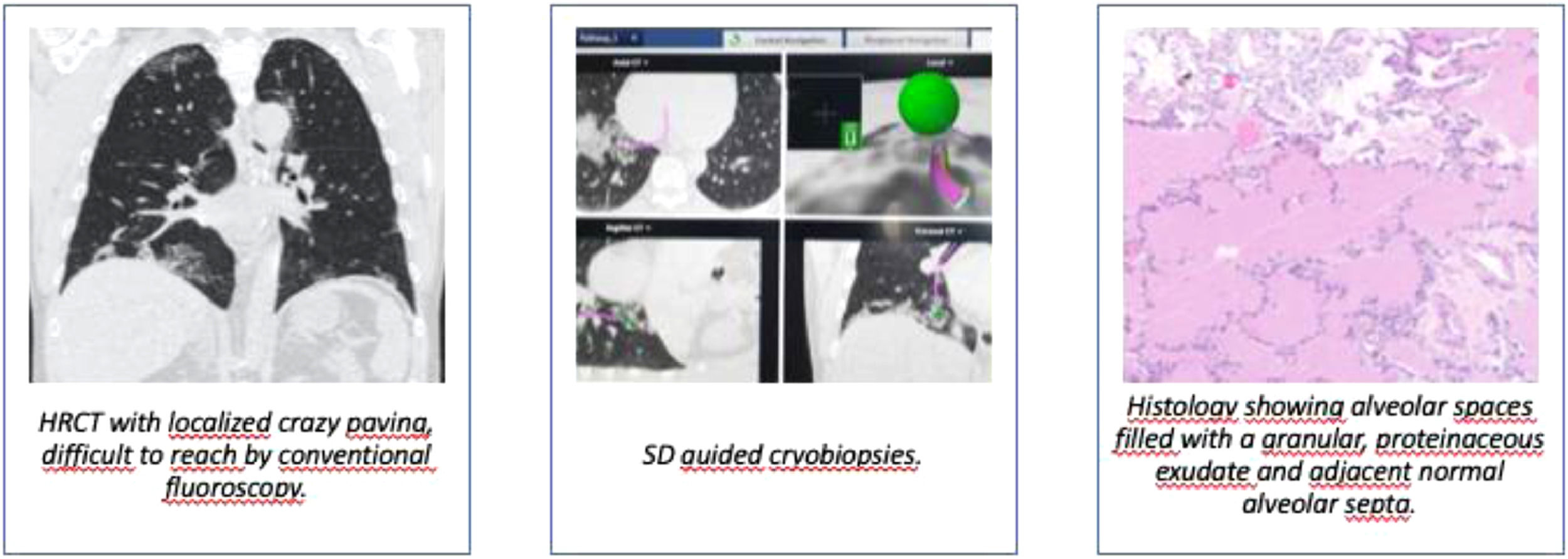 A pilot study on the use of the super dimension navigation system for ...