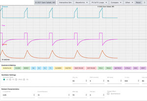VentSim© software main features> The figure shows the simulation environment of VCV ventilation in the main modality offered by the software.