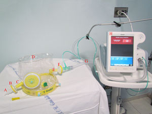 Fig. 1: Helmet CPAP configuration. The figure shows the new helmet CPAP configuration allowing tidal volume measurement. From left to right, connector (A), HEPA filter (B), expiratory port (C), helmet (D), inspiratory port (E), HEPA filter (F), single limb circuit (G).