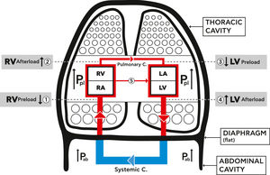 Schematic diagram showing the mechanical effects of lung hyperinflation on the cardiovascular system (CVS). Hyperinflation increases intra thoracic pressure (Pleural pressure (Ppl)), the pressure on the parts of the CVS inside the thoracic cavity, increases abdominal pressure (Pab) and flattens the diaphragm. 1. RV Preload reduced: decreased venous blood return due to venous compression {Ppl +Pab+ flat diaphragm) and increase RA pressure. 2. RV Afterload increased: increased RV end-diastolic and pleural pressures, and increased resistance of pulmonary circulation. 3. LV Preload reduced: decreased filling pressure and compliance of LV plus cardiac fossa's external compression (Ppl). 4. LV Afterload increased: increased LV trans -mural and abdominal pressures. 5. Increased ventricular interdependence and leftward shift of septum. {Pulmonary C.=circulation, Systemic C.=circulation, RA=Right Atrium, RV= Right Ventricle, LA= Left Atrium, LV= Left Ventricle, Ppl= Plural pressure, Pab= Abdominal pressure}.