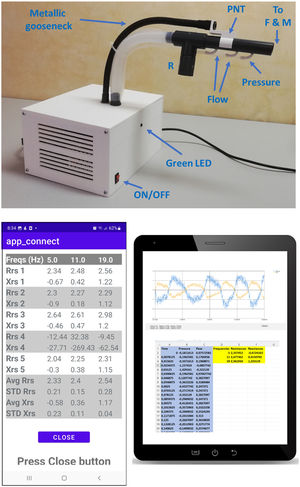 Implementation of the setting. Top: External view of the device built. The front side has the power on/off switch and a green LED that lights when the patient is asked (by an App audio message) to take the mouthpiece for carrying out an oscillometry measurement. A flexible metallic gooseneck allows easily adjusting the optimal position of the mouthpiece for each patient. The differential pressure sampled across the pneumotachograph (PNT) provides a measurement of flow. Pressure is sampled close to the connecting point to a filter and mouthpiece (F & M). A resistor (R) connected in parallel allows the patient