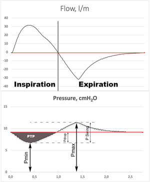 Illustration of graphic measurement of minimum inspiratory pressure (Pmin), maximum expiratory pressure (Pmax) and mean pressure (Pmean), (red line). The PSwing is defined as: Pmax – Pmin. The Pdrop is defined as: Pmean – Pmin. The gray shade area represents the inspiratory pressure time product (PTPinsp).