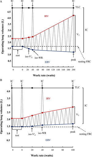 Operating lung volume (in liters, L) plot versus cycle work rate (WR, in watts). Inspiratory capacity maneuvers (dotted grey lines) and tidal volume evolution (dotted gray lines) are shown at rest (0 W), iso-ventilation (iso-V'E), iso-work rate (iso-WR) and at peak exercise. TLC = total lung capacity; IRV = inspiratory reserve volume (shown in red); ERV = expiratory reserve volume (shown in blue); VT = tidal volume; IC = inspiratory capacity. Data are presented as means of the whole group in healthy controls (2A) vs means of the whole group in congenital central hypoventilation syndrome (CCHS) patients (2B). In the controls, VT increases with work rate by encroaching on both IRV and ERV, whereas in CCHS patients ERV is not recruited so that VT increases by encroaching on IRV. Dot points indicating IC show the IC manoeuver performed at rest, at iso-WR and at peak during the exercise testing.