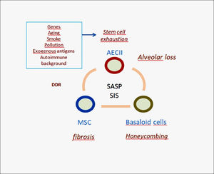 Simplified scheme of IPF pathogenesis. The aberrant signaling (SASP) provided by senescent AECII is able to trigger migration and deranged differentiation of mesenchymal stem cells causing myofibroblast accumulation and interstitial fibrosis. Due to senescence induced senescence (SIS) this process may trigger bronchiolar basal cell precursors affecting their differentiation. Abnormal basaloid cells may in turn provide pro-fibrotic signals to neighboring mesenchymal cells. This complex mechanism may severely affect the alveolar/bronchiolar junctions with eventual formation of honeycomb cysts, progressive remodeling and functional loss. DDR: DNA Damage Response; AECII: alveolar Epithelial Cells type-II; MSC: Mesenchymal Stem Cells; SASP: Senescence Associated Secretory Phenotype; SIS: Senescence Induced Senescence.