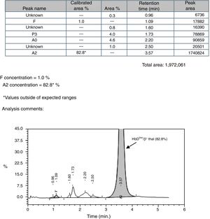 CE-HPLC showing characteristic peak of HbDIran/β0 thal [cds 41/42 (-CTTT)].