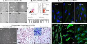 Human adipose tissue-derived stem cells culture, viability and characterization. (A) Human mesenchymal stem cells were isolated from adipose tissue in low-glucose Dulbecco